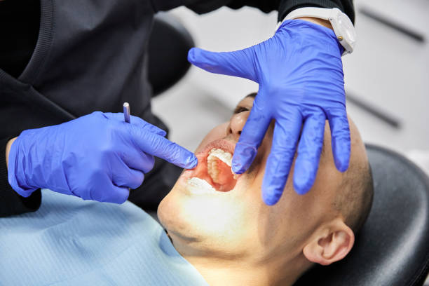 Best Dentist for Tooth Abscess  in Alderwood Manor, WA
